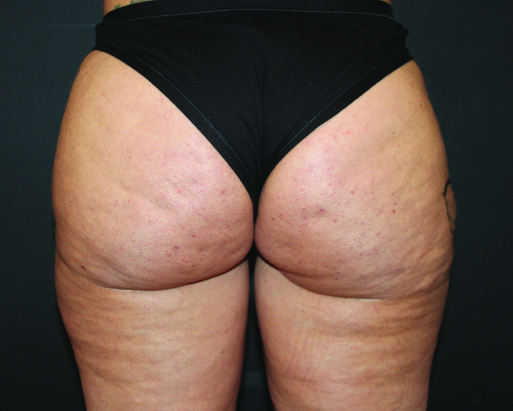 lipoauzione-new-post-1