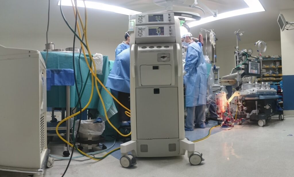 Liposuzione e Liposcultura Napoli con Tecnologia Argon Plasma 1 Photo Liposuction Argon Plasma