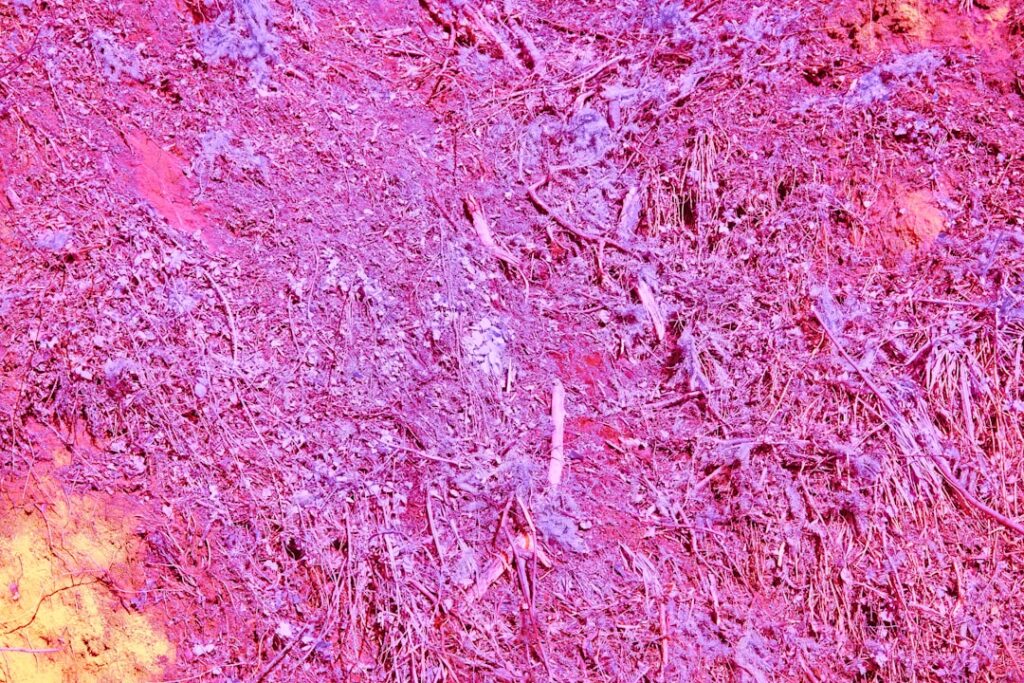 Blefaroplastica Napoli: Ringiovanire lo Sguardo Senza Cicatrici Visibili 1 Photo Blepharoplasty